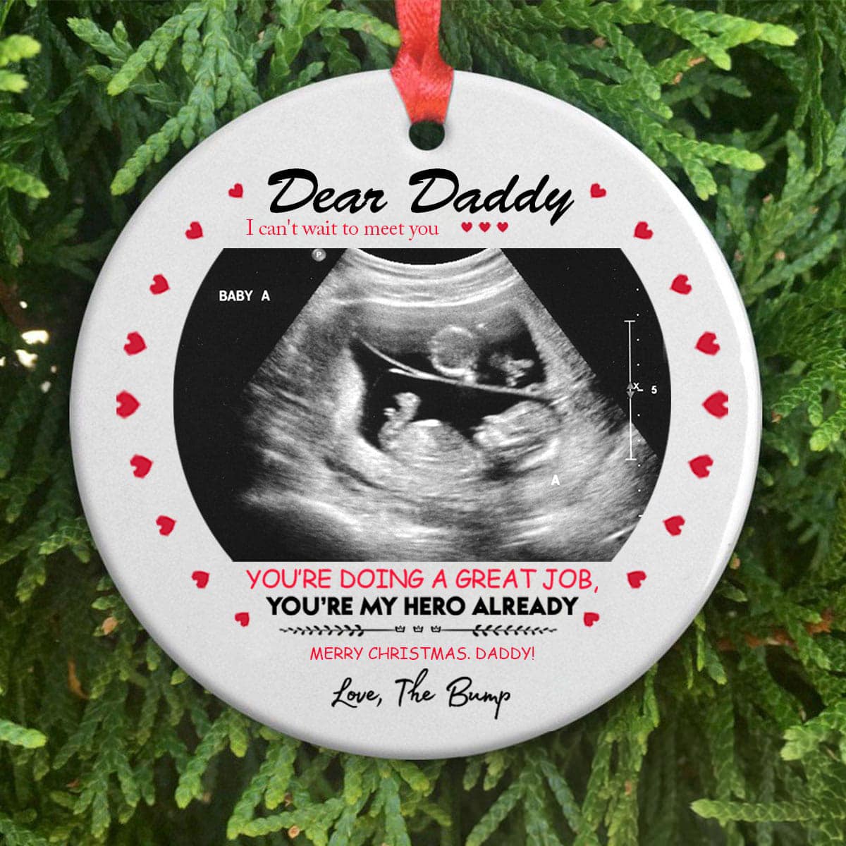 Christmas Day Gift For Daddy To Be Sonogram Circle Ornament
